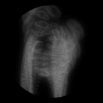 A day in Asia 20200817 DigitalMicroscope version