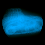 A day in Asia 20200904 DigitalMicroscope version