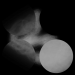 A day in Asia 20200906 CompoundDigitalMicroscope version