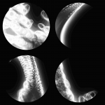 A day in Asia 20201220 DigitalMicroscope version