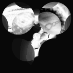 A day in Asia 20210605 RecursiveCompoundDigitalMicroscope version