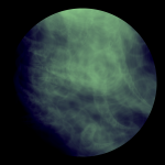 A day in Asia 20210611 DigitalMicroscope version