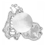 A day in Asia 202110042007 DigitalMicroscope version