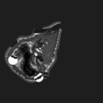 Just alive (with no particular aim) 20221007 Compound Microscope version